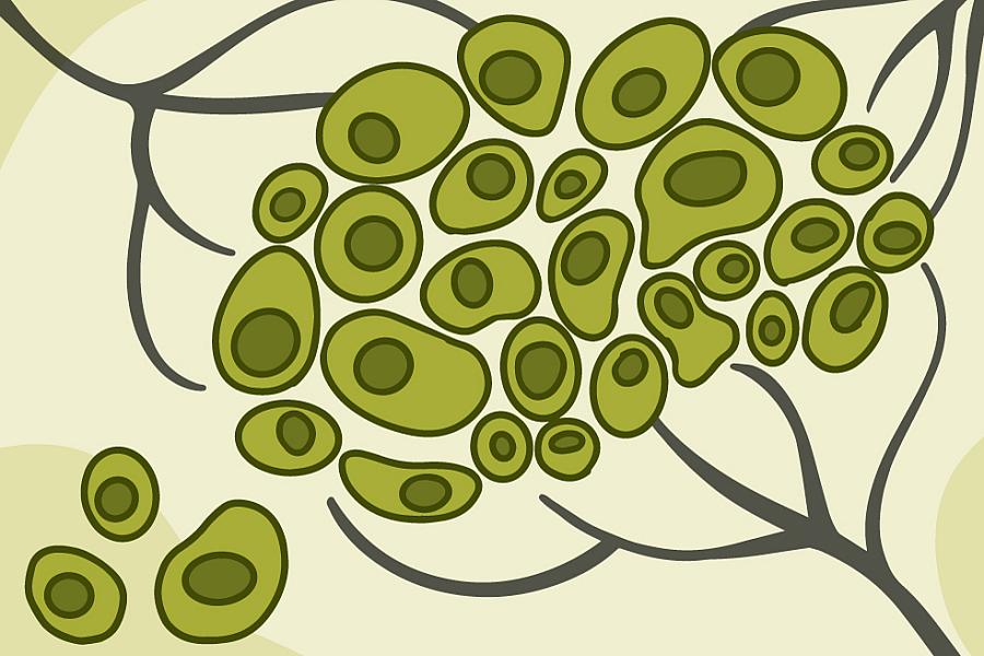 Illustration of cells migrating out of a tumor.